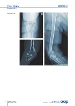 Preview for 36 page of AAP LOQTEQ Distal Dorsolateral Humerus Plate... Manual