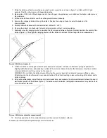 Preview for 3 page of Abbott AMPLATZER Sizing Balloon II Series Instructions For Use Manual