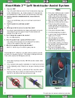 Preview for 1 page of Abbott Heartmate 3 Quick Start Manual