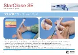 Preview for 9 page of Abbott StarClose SE Manual