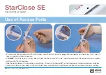 Preview for 14 page of Abbott StarClose SE Manual