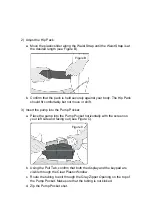 Preview for 5 page of AbbVie Hip Pack Instructions For Use Manual