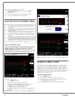 Preview for 12 page of Abiomed Impella 5.5 User Manual