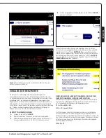 Preview for 29 page of Abiomed Impella 5.5 User Manual