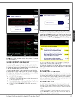 Preview for 65 page of Abiomed Impella 5.5 User Manual