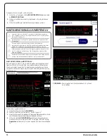 Preview for 80 page of Abiomed Impella 5.5 User Manual