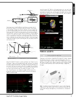 Preview for 5 page of Abiomed Impella LD User Manual