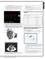 Preview for 9 page of Abiomed Impella LD User Manual