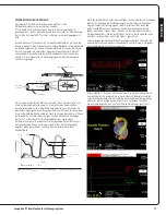 Preview for 19 page of Abiomed Impella LD User Manual