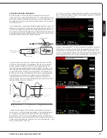 Preview for 33 page of Abiomed Impella LD User Manual