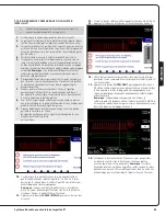 Preview for 65 page of Abiomed Impella LD User Manual