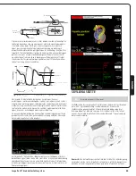 Preview for 88 page of Abiomed Impella LD User Manual