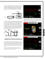 Preview for 101 page of Abiomed Impella LD User Manual