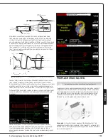 Preview for 127 page of Abiomed Impella LD User Manual