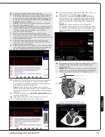 Preview for 143 page of Abiomed Impella LD User Manual