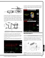 Preview for 153 page of Abiomed Impella LD User Manual