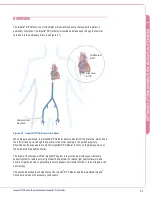 Preview for 16 page of Abiomed Impella RP Instructions For Use & Clinical Reference Manual