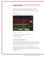 Preview for 33 page of Abiomed Impella RP Instructions For Use & Clinical Reference Manual