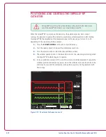 Preview for 49 page of Abiomed Impella RP Instructions For Use & Clinical Reference Manual