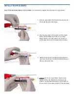 Preview for 3 page of Abiomed Impella Sidearm Retainer Instructions For Use & Reference Manual