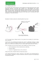 Preview for 93 page of ACKERMANN 16-2000-700 Instructions For Use Manual