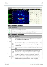 Preview for 49 page of ACS A1040 MIRA Operation Manual