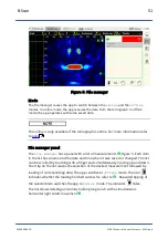 Preview for 51 page of ACS A1040 MIRA Operation Manual