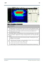 Preview for 56 page of ACS A1040 MIRA Operation Manual