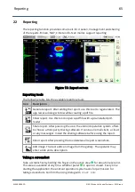 Preview for 65 page of ACS A1040 MIRA Operation Manual