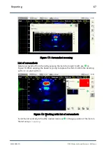 Preview for 67 page of ACS A1040 MIRA Operation Manual