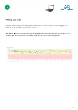 Preview for 25 page of Activ8rlives Pulse Oximeter 3 Manual