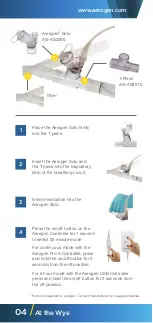 Preview for 6 page of Aerogen Solo AG-AS3200 Setup Manual