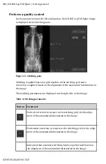 Предварительный просмотр 38 страницы AGFA DR Full Leg Full Spine User Manual