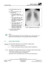 Preview for 255 page of AGFA DRYSTAR 5302 100 Service Manual