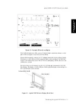 Preview for 21 page of Agilent Technologies M1205A V24 Service Manual