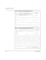 Предварительный просмотр 49 страницы Agilent Technologies M1770A User Manual