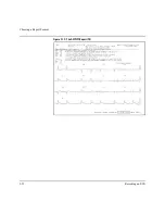 Предварительный просмотр 57 страницы Agilent Technologies M1770A User Manual