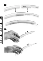 Preview for 8 page of Alaxo AlaxoStent C Instructions For Use Manual