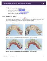 Preview for 137 page of Align Technology iTero Element 5D User Manual