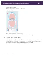 Preview for 139 page of Align Technology iTero Element 5D User Manual