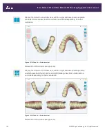 Preview for 148 page of Align Technology iTero Element 5D User Manual