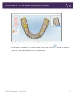 Preview for 169 page of Align Technology iTero Element 5D User Manual