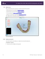 Preview for 172 page of Align Technology iTero Element 5D User Manual