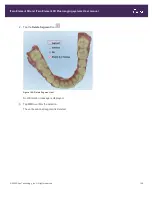 Preview for 173 page of Align Technology iTero Element 5D User Manual