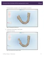 Preview for 175 page of Align Technology iTero Element 5D User Manual