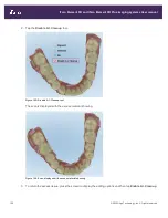 Preview for 178 page of Align Technology iTero Element 5D User Manual