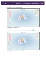 Preview for 180 page of Align Technology iTero Element 5D User Manual