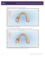 Preview for 186 page of Align Technology iTero Element 5D User Manual