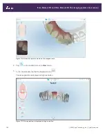 Preview for 188 page of Align Technology iTero Element 5D User Manual