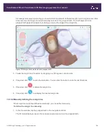 Preview for 193 page of Align Technology iTero Element 5D User Manual